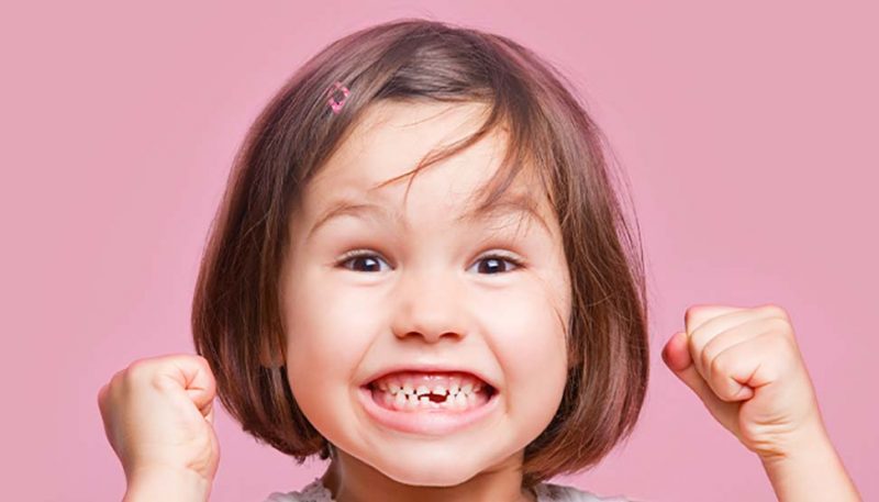 o-tratamento-ortodontico-pode-ser-feito-em-dentes-de-leite_2